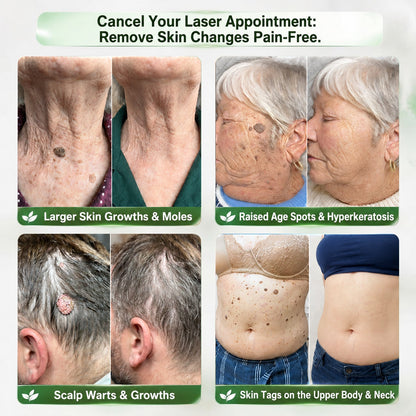 InnoMedix® 🧬𝑷𝑫𝑹𝑵 𝑨𝒏𝒕𝒊-𝑨𝒈𝒊𝒏𝒈 & 𝑻𝒂𝒓𝒈𝒆𝒕𝒆𝒅 𝑺𝒌𝒊𝒏 𝑹𝒆𝒏𝒆𝒘𝒂𝒍 𝑺𝒕𝒊𝒄𝒌