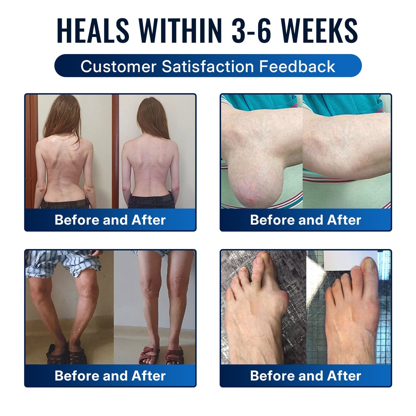 🎁Healrize® Bee Venom Joint Relief Cream 💞Targets stiff, sore joints in knees, hands, shoulders, back & more — so you can move easier every day（英国版）