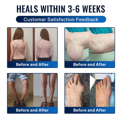 🎁Healrize® Bee Venom Joint Relief Cream 💞Targets stiff, sore joints in knees, hands, shoulders, back & more — so you can move easier every day（英国版）
