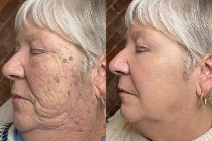 InnoMedix® 🧬𝑷𝑫𝑹𝑵 𝑨𝒏𝒕𝒊-𝑨𝒈𝒊𝒏𝒈 & 𝑻𝒂𝒓𝒈𝒆𝒕𝒆𝒅 𝑺𝒌𝒊𝒏 𝑹𝒆𝒏𝒆𝒘𝒂𝒍 𝑺𝒕𝒊𝒄𝒌