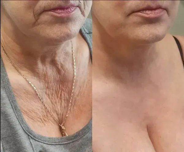 InnoMedix® 🧬𝑷𝑫𝑹𝑵 𝑨𝒏𝒕𝒊-𝑨𝒈𝒊𝒏𝒈 & 𝑻𝒂𝒓𝒈𝒆𝒕𝒆𝒅 𝑺𝒌𝒊𝒏 𝑹𝒆𝒏𝒆𝒘𝒂𝒍 𝑺𝒕𝒊𝒄𝒌